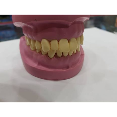 Acrylic Teeth Banna