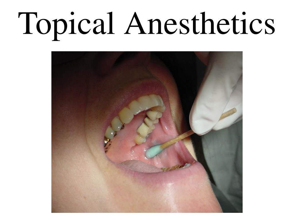 Topical Anesthesia