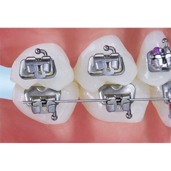 Ortho Buccal Tube