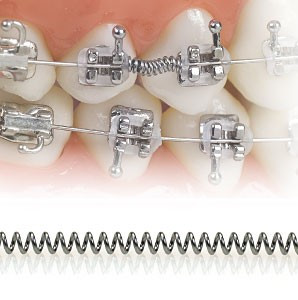 Ortho Open Coil